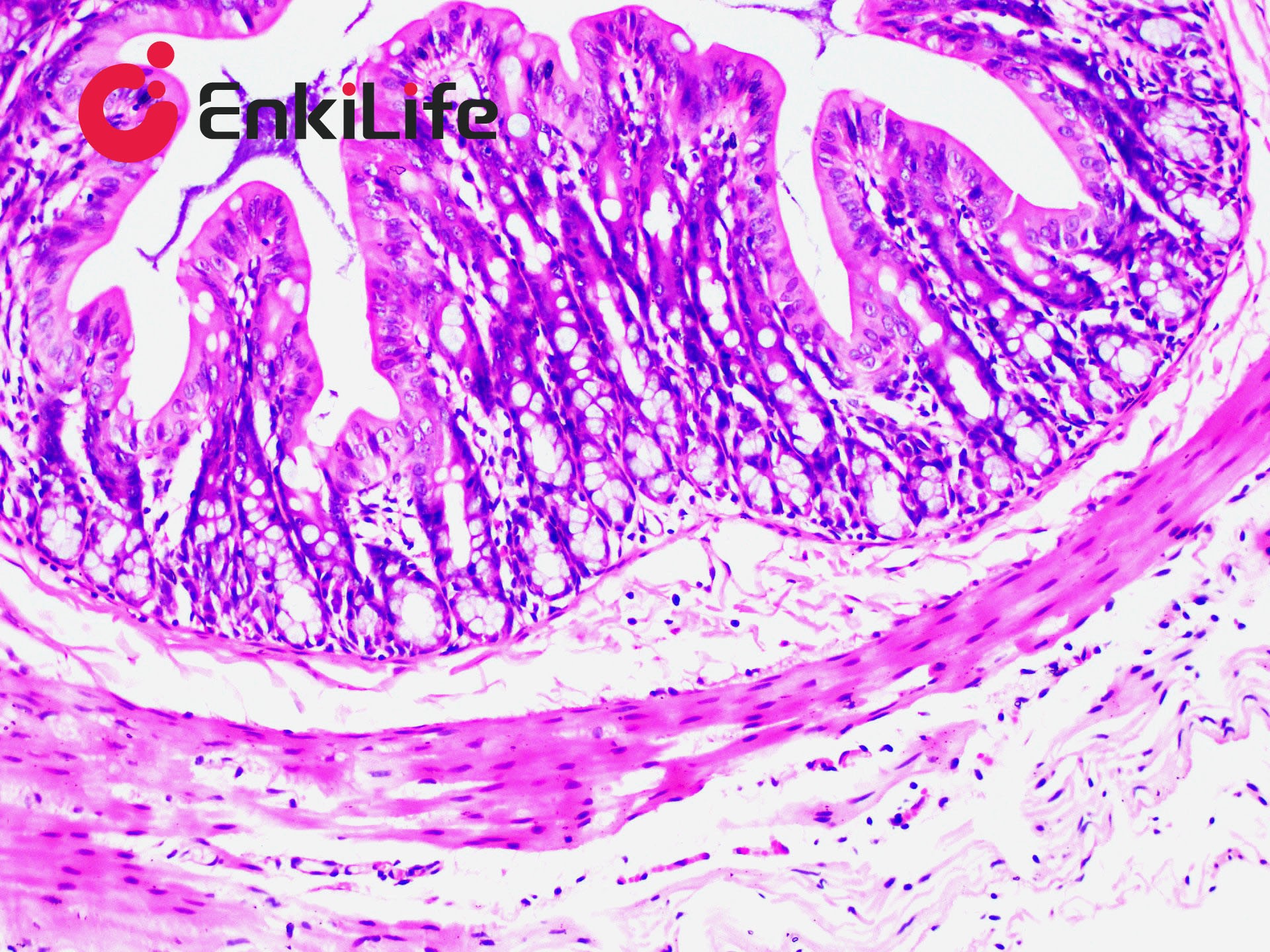 What Do Pathological Staining Solutions Actually Stain? Understand Its Core Principles