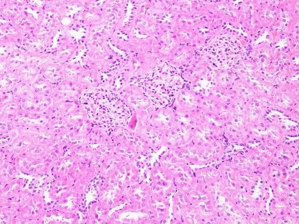 Decoding the Fundamental Language of Pathological Diagnosis — H&E Staining