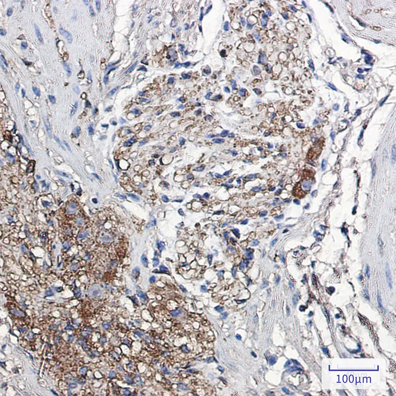 alpha Synuclein Rabbit Monoclonal Antibody