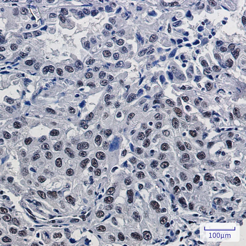 Mre11 Rabbit Monoclonal antibody