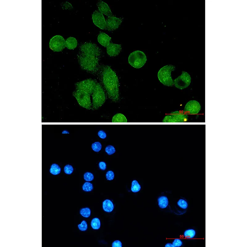 Nibrin Rabbit Monoclonal Antibody