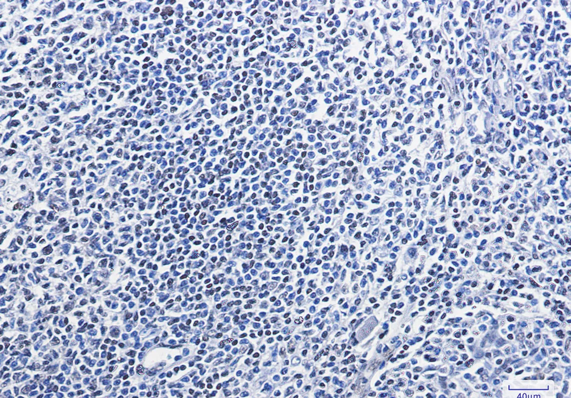 HMGB1 Rabbit Monoclonal antibody