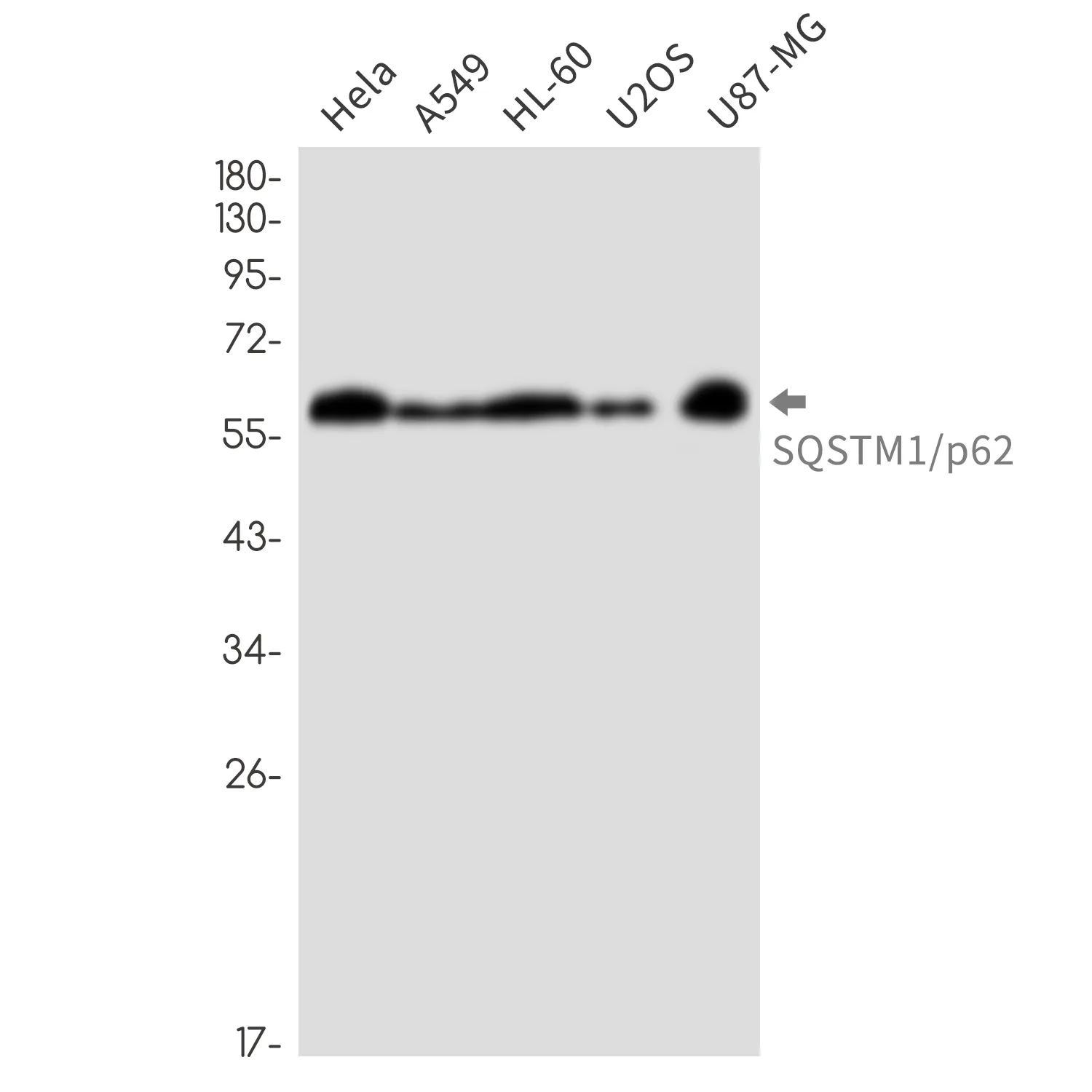 SQSTM1/p62 Rabbit Monoclonal Antibody