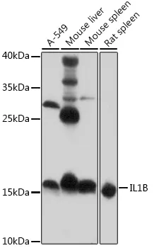 IL-1 beta Rabbit Polyclonal Antibody($99/20μL)