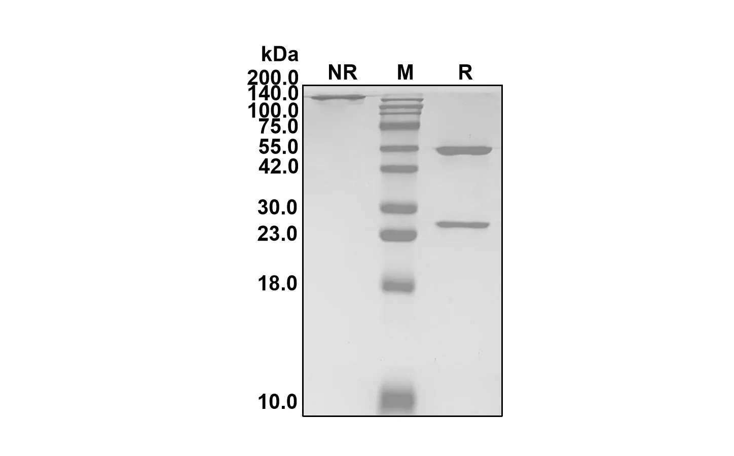 Anti-Human Staphylococcus aureus Toxin A (Berlimatoxumab Biosimilar)(RUO)