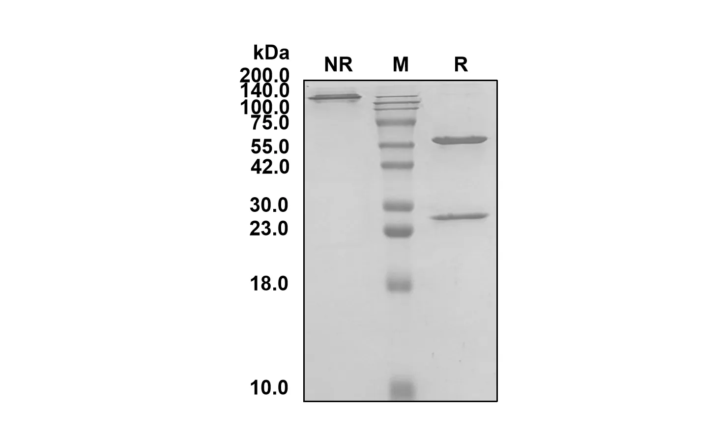 Anti-Human C5 (Crovalimab Biosimilar)(RUO)
