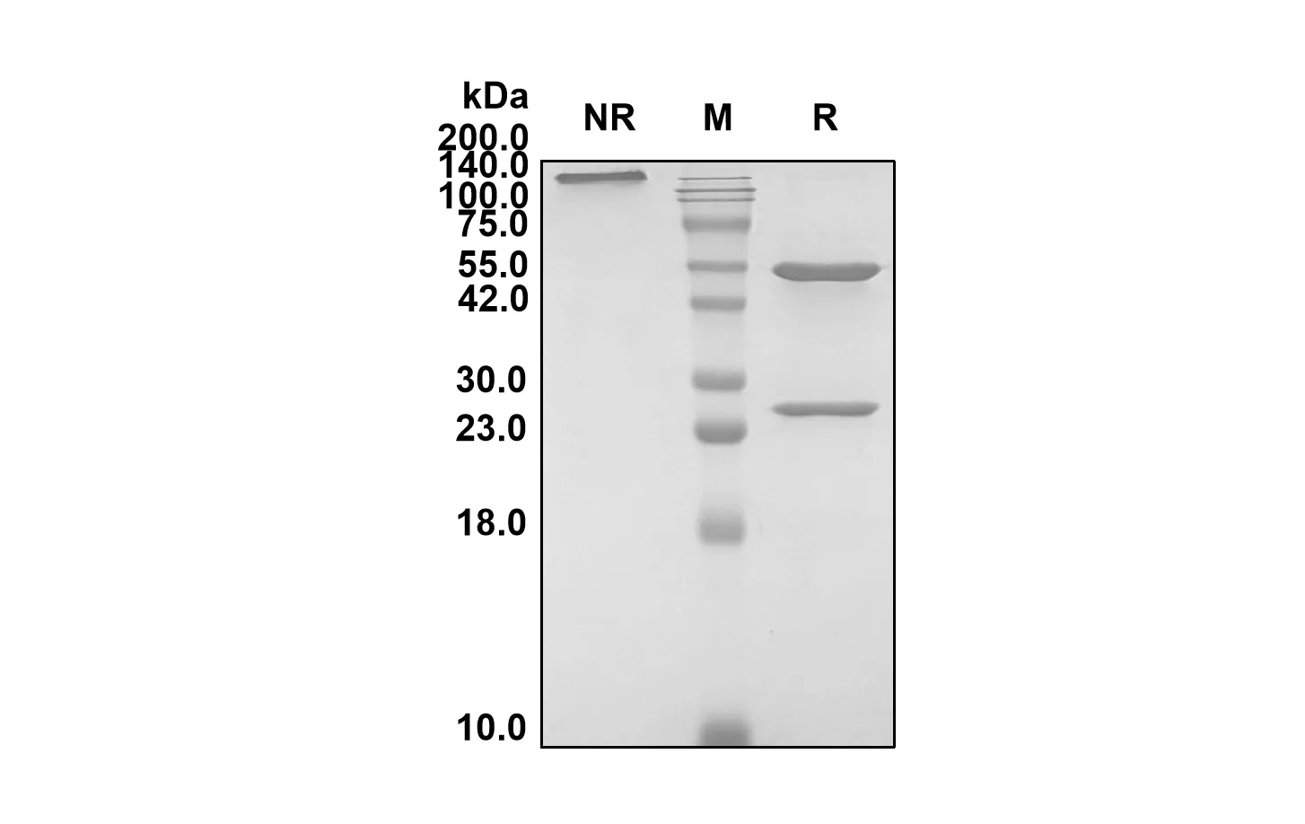 SDS-PAGE Anti-Human ERBB2/CD340/HER2 (Disitamab Biosimilar)(RUO) ABS00185