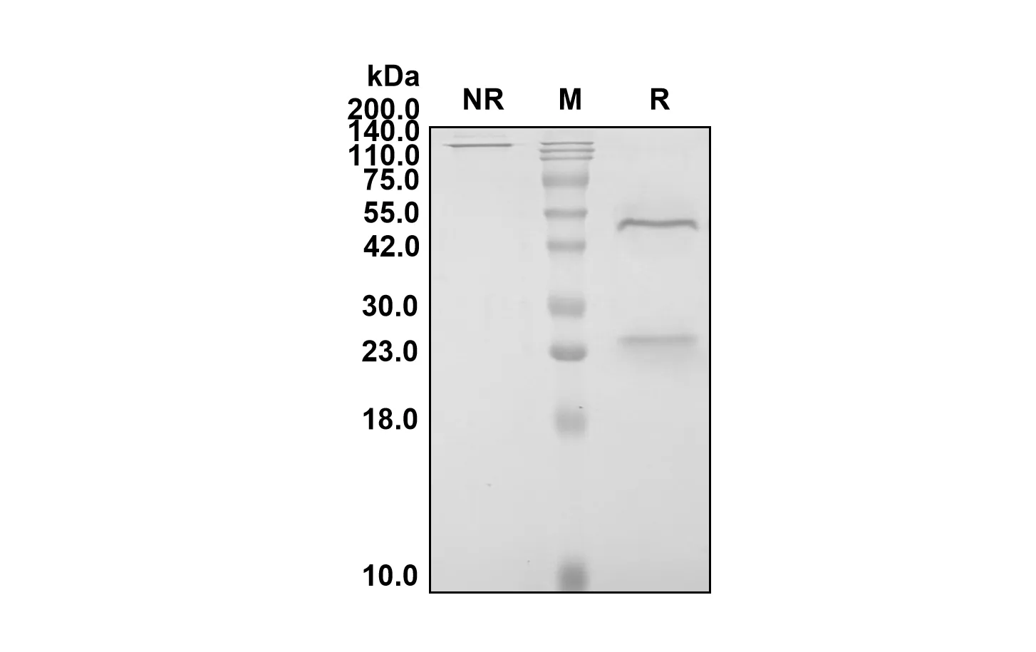 Anti-Human PCSK9 (Evolocumab Biosimilar)(RUO)