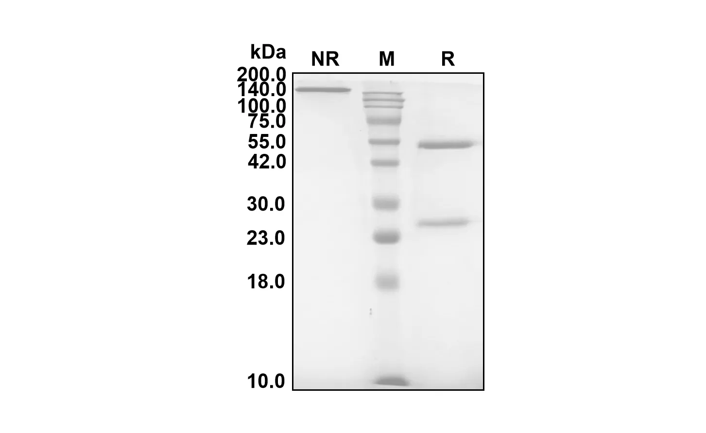 Anti-Human NGF (Luvagrobart Biosimilar)(RUO)
