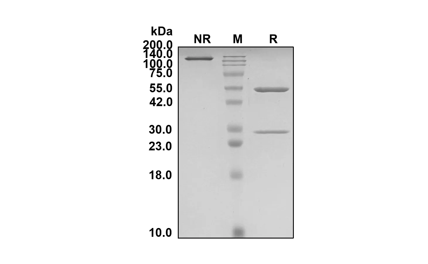 Anti-Human ERBB2/CD340/HER2 (Marstacimab Biosimilar)(RUO)