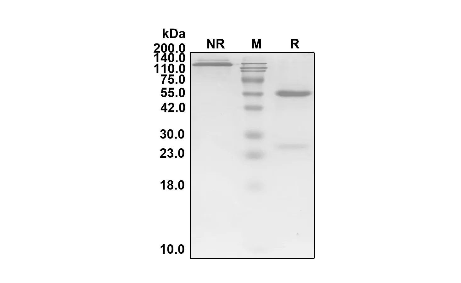 Anti Respiratory Syncytial Virus (Nirsevimab Biosimilar)(RUO)