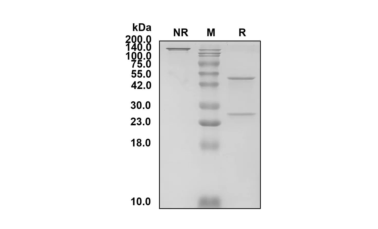 Anti-Human Anthrax Protective Antigen (Obiltoxaximab Biosimilar)(RUO)
