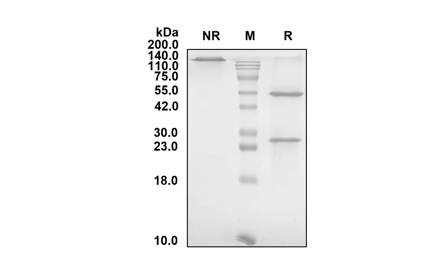 Anti-Human PCSK9 (Ongericimab Biosimilar)(RUO)