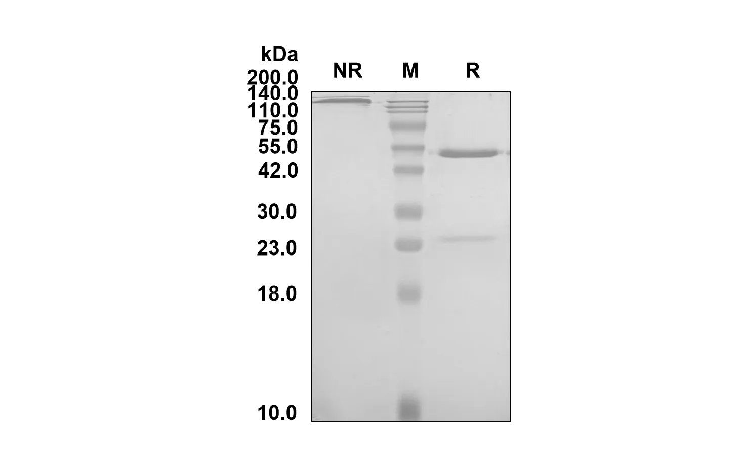 Anti-Human OxLDL (Orticumab Biosimilar)(RUO)
