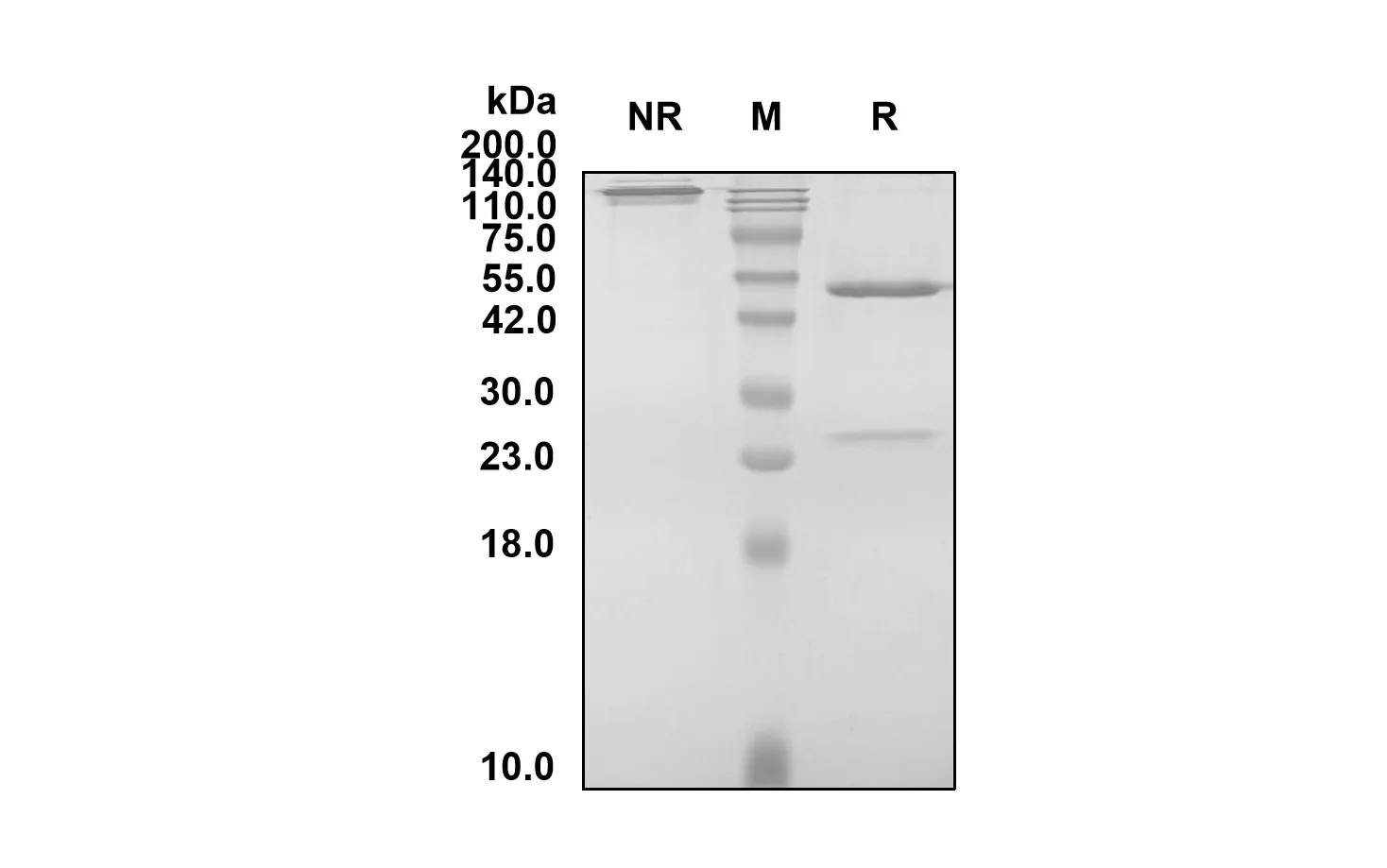 Anti-Human CSF2 (Otilimab Biosimilar)(RUO)