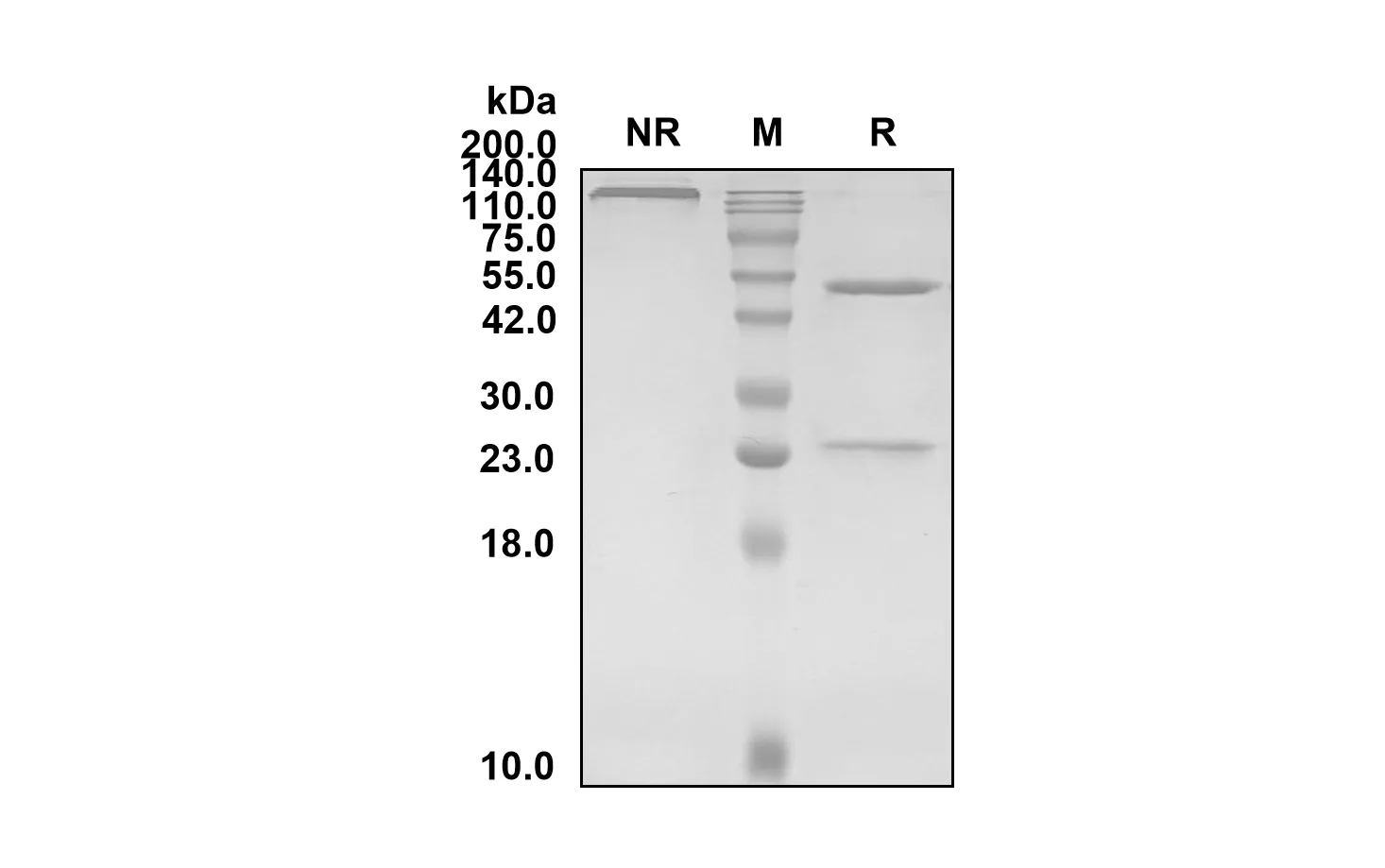 Anti-Human ROR2 (Ozuriftamab Biosimilar)(RUO)