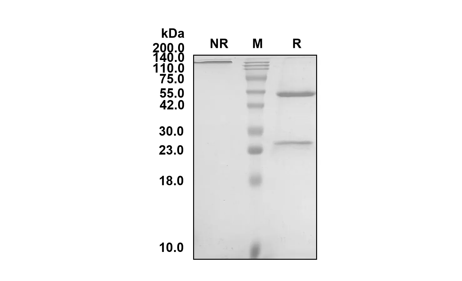 Anti-Human CSF2 (Plonmarlimab Biosimilar)(RUO)