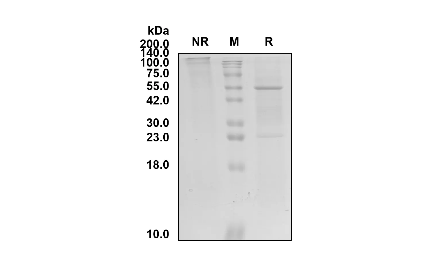 Anti-Human ACVR1 (Prafnosbart Biosimilar)(RUO)