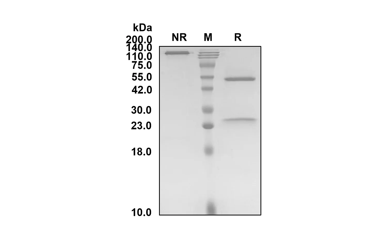 Anti-Human VIM (Pritumumab Biosimilar)(RUO)