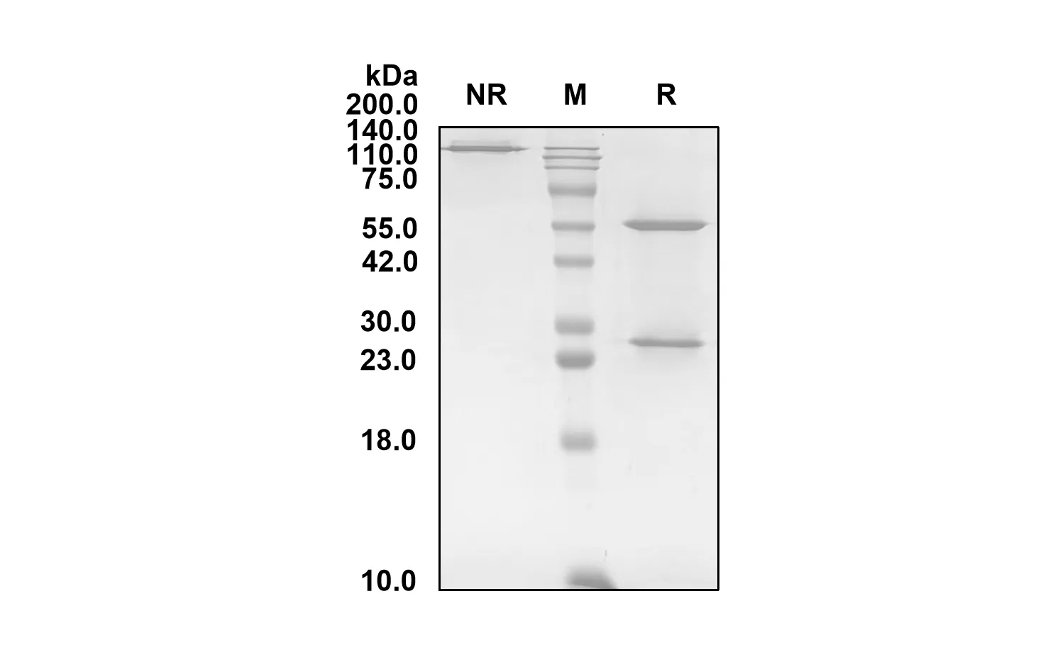 Anti-Human SOST (Resugosbart Biosimilar)(RUO)