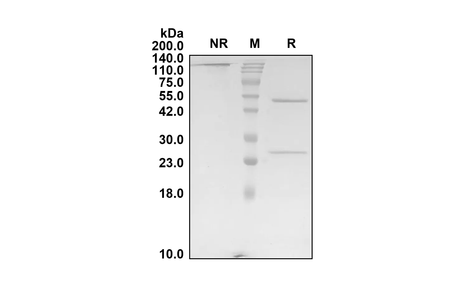 Anti-Human SIGLEC2/CD22 (Suciraslimab Biosimilar)(RUO)