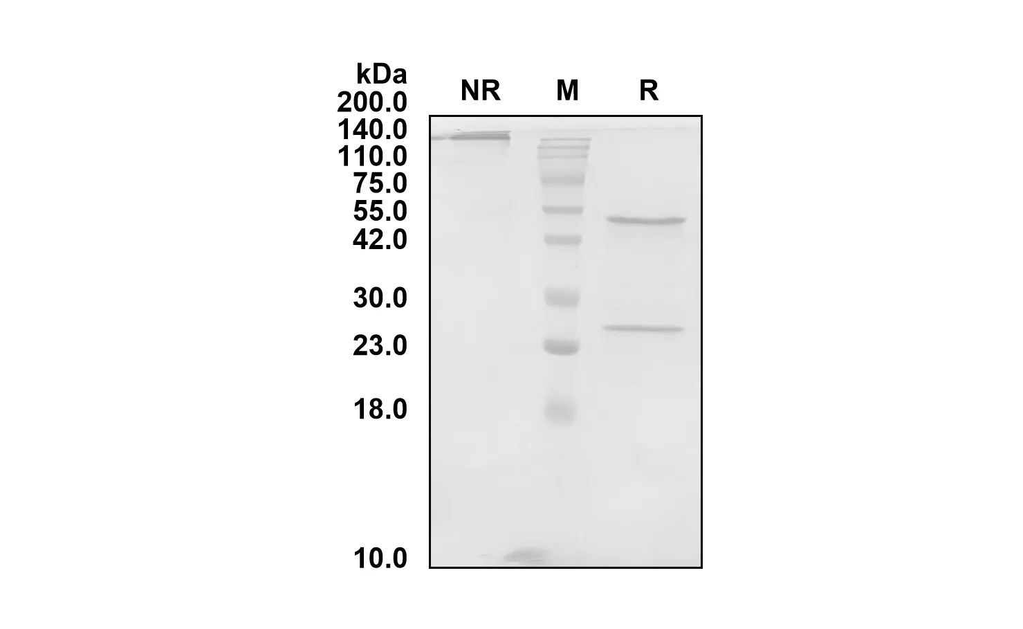 Anti-Human C1S (Sutimlimab Biosimilar)(RUO)