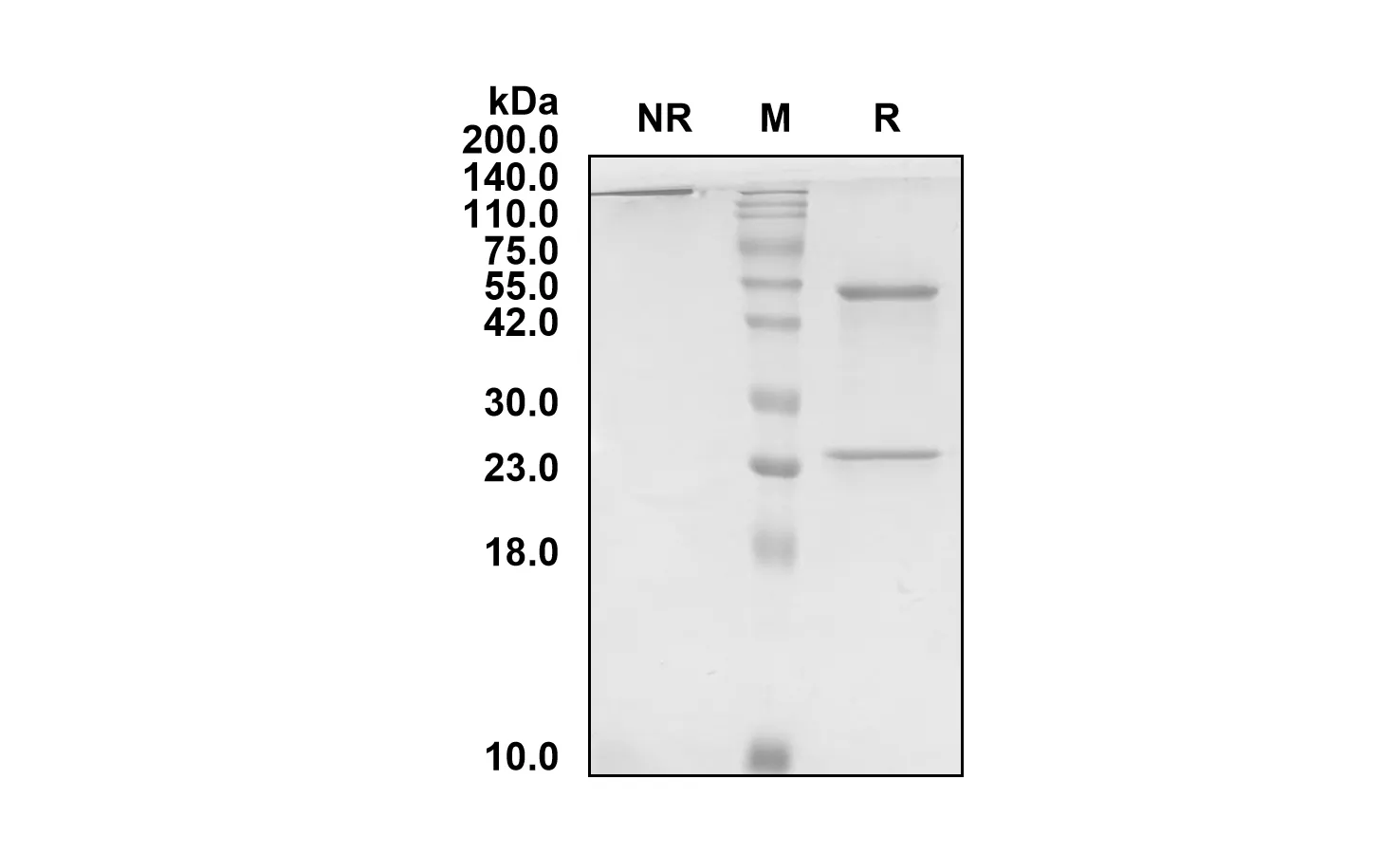 SDS-PAGE Anti-Human FZD10/CD350 (Tabituximab Biosimilar)(RUO) ABS00688