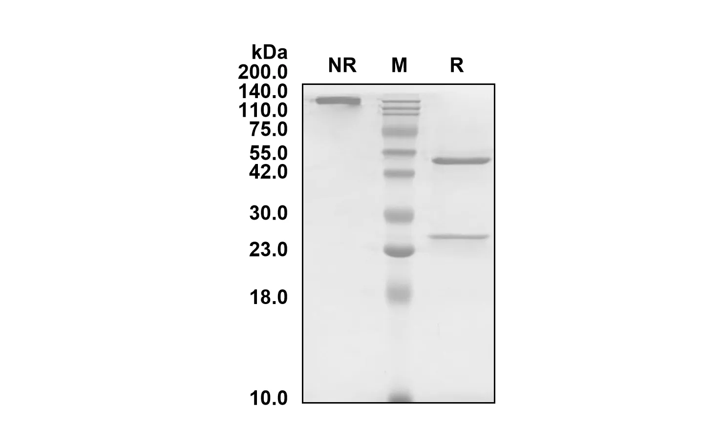 SDS-PAGE Anti-Human C5 (Tesidolumab Biosimilar)(RUO) ABS00714