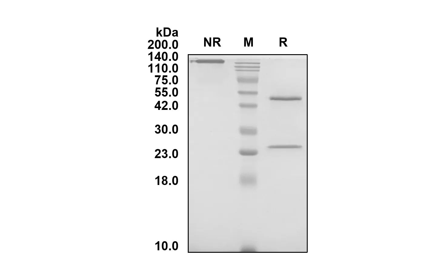 Anti-Human AOC3/VAP1 (Timolumab Biosimilar)(RUO)