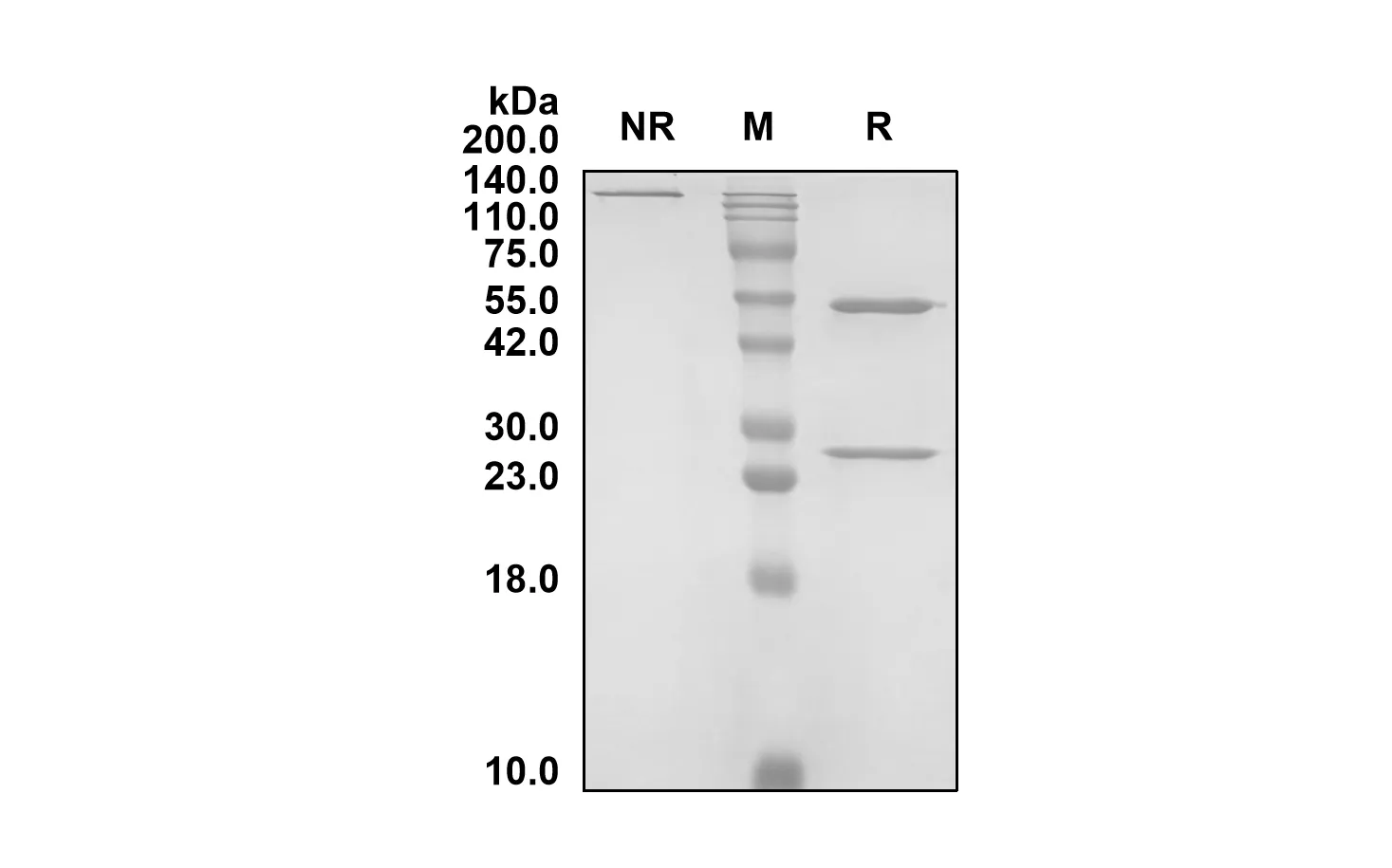 SDS-PAGE Anti-Human KLRG1 (Ulviprubart Biosimilar)(RUO) ABS00759