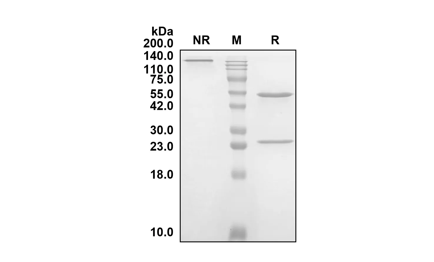 Anti-Human SLC34A2 (Upinitatug Biosimilar)(RUO)