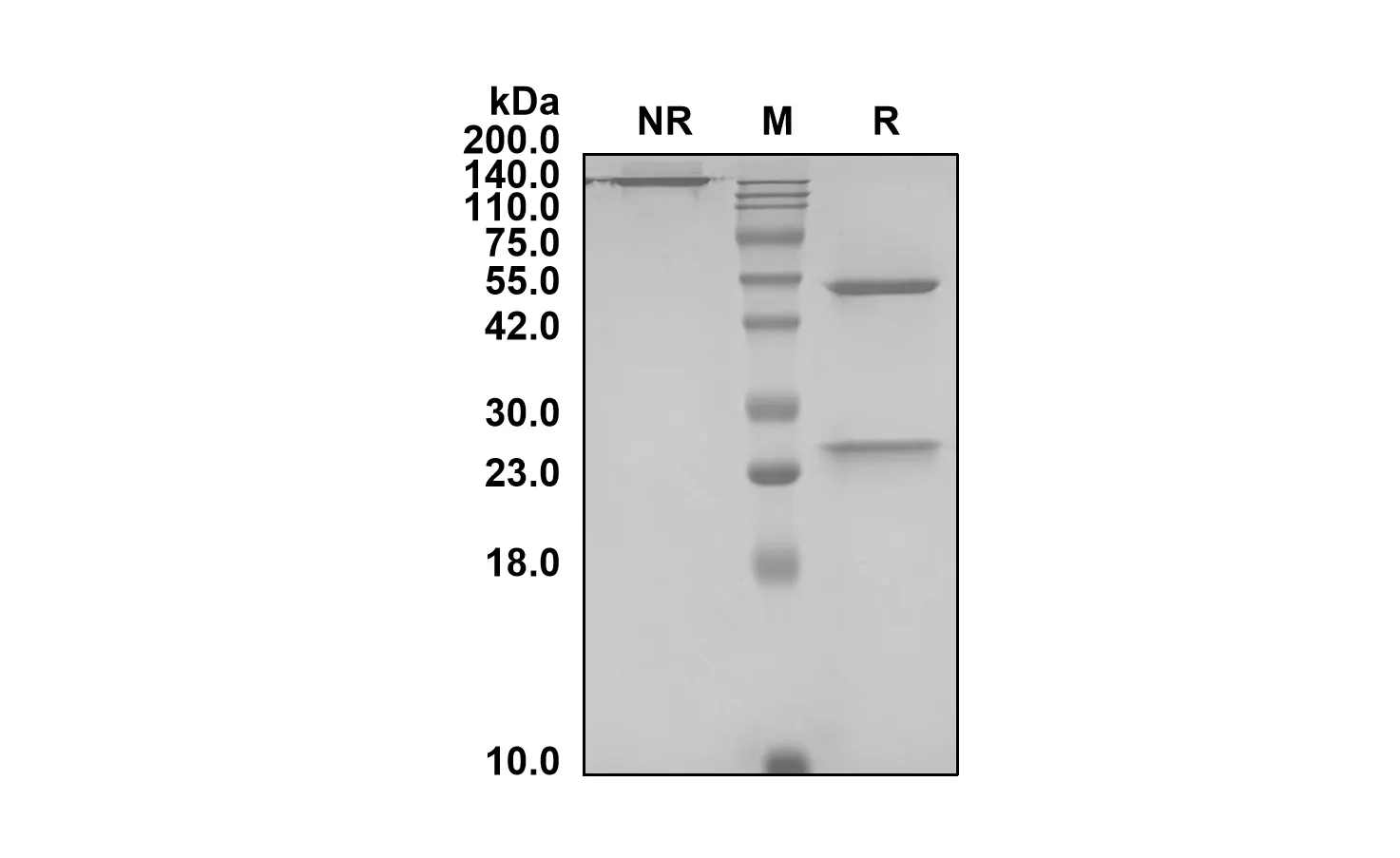 Anti-Human C5 (Vensobafusp Biosimilar)(RUO)