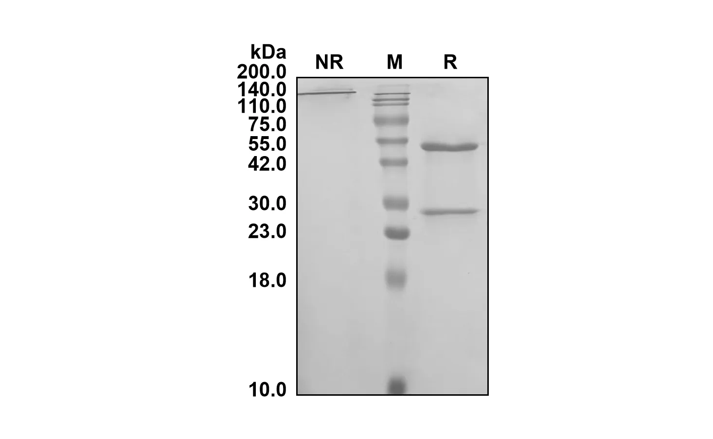 Anti-Human C5 (Vilobelimab Biosimilar)(RUO)