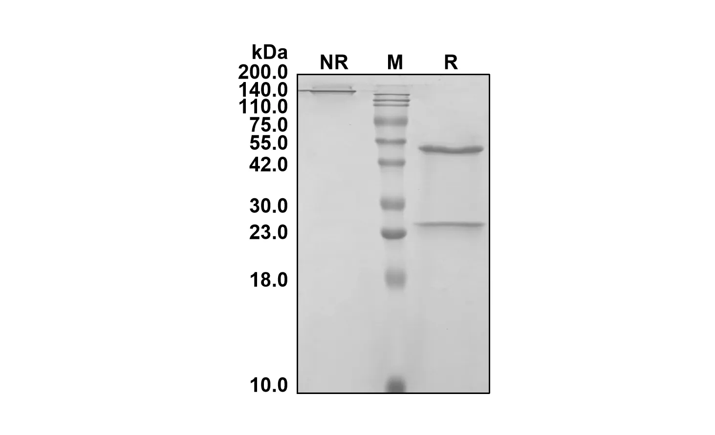 Anti-Human ADCYAP1/PACAP (Vipalanebart Biosimilar)(RUO)