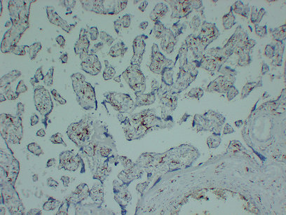 CD163 Mouse Monoclonal Antibody