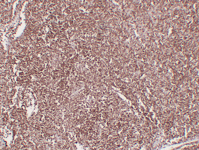 CD1a Mouse Monoclonal Antibody