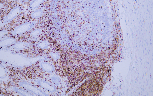CD43 Mouse Monoclonal Antibody