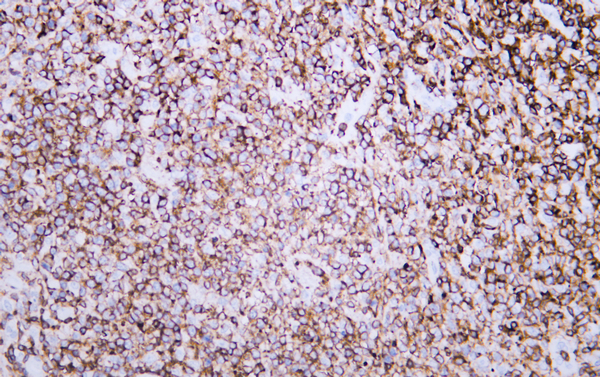 CD45 Mouse Monoclonal Antibody