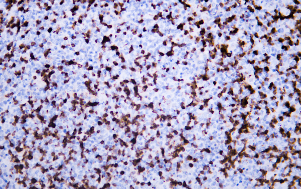 CD7 Mouse Monoclonal Antibody