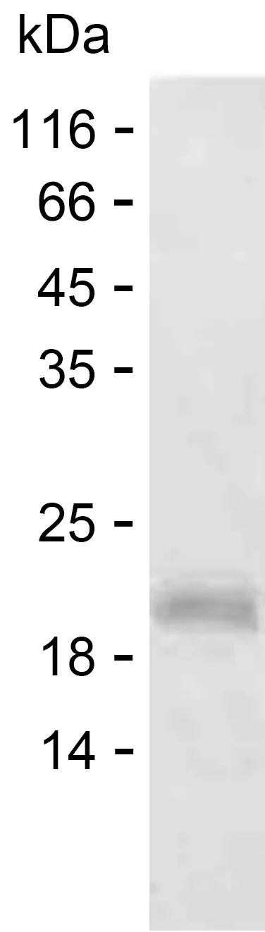 SDS-PAGE Recombinant Human ZNF823 Protein PEH4794