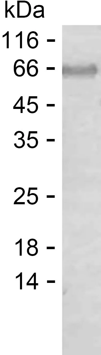 SDS-PAGE Recombinant Human CLGN Protein PEH8093