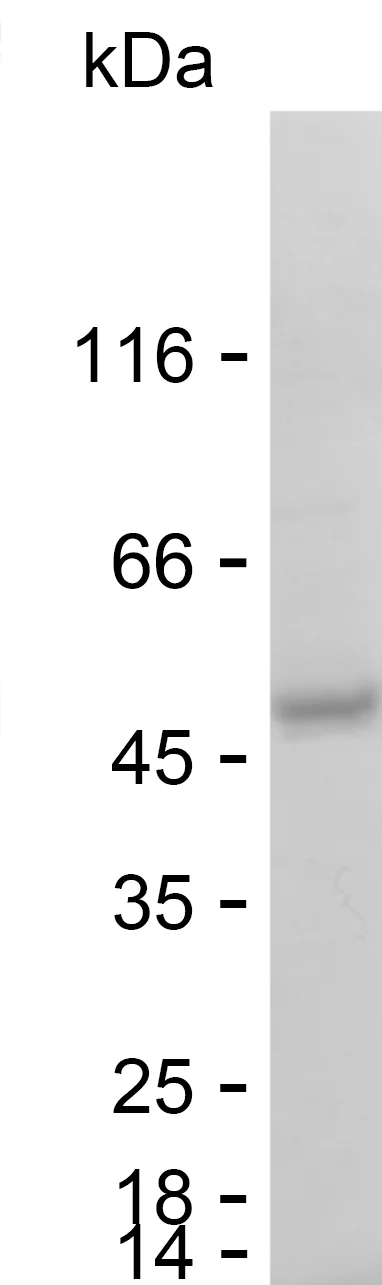 SDS-PAGE Recombinant Human DEFB103A Protein PHH6629
