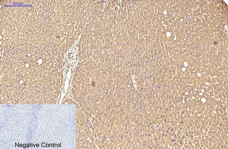 Transferrin Mouse Monoclonal Antibody