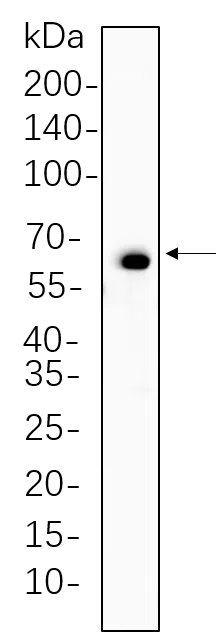 Paxillin (Phospho Tyr118) Rabbit Monoclonal Antibody - Size: 200µL