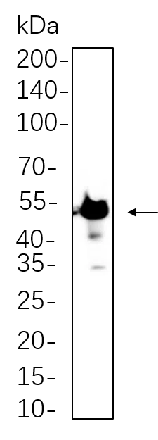 ß3 TubµLin Rabbit Monoclonal Antibody - Size: 50µL