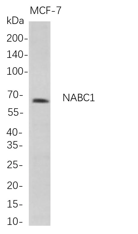 NABC1 Rabbit Monoclonal Antibody - Size: 50µL