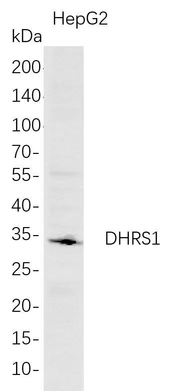 DHRS1 Rabbit Monoclonal Antibody - Size: 100µL