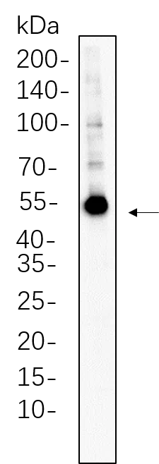 CaMKII a Rabbit Monoclonal Antibody - Size: 200µL