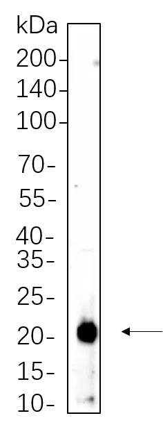 p21 Rabbit Monoclonal Antibody