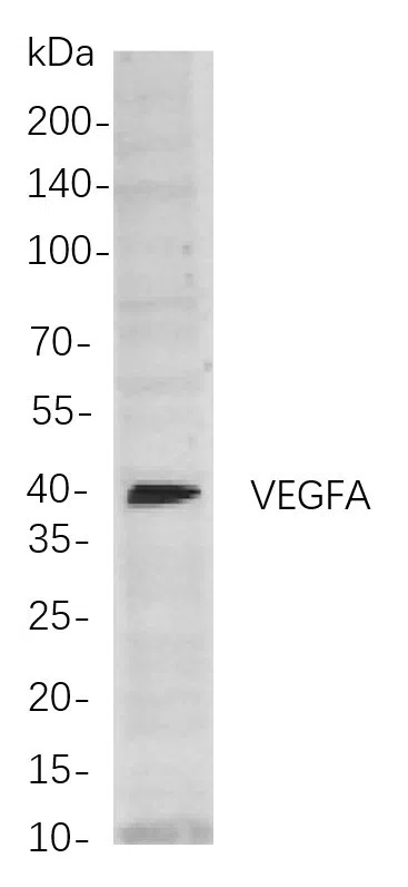 VEGFA Rabbit Monoclonal Antibody - Size: 200µL